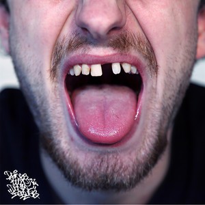 *** Booze & Dental Issues