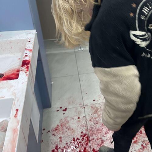 шрамы (Explicit)