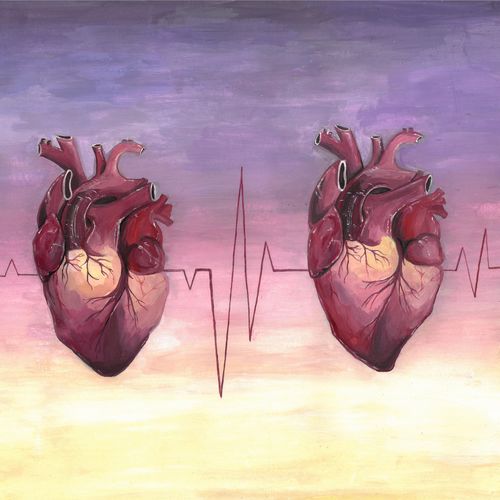 Зависимость