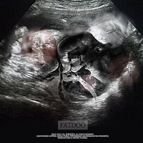 나는 잉태되었다 (我怀孕了)