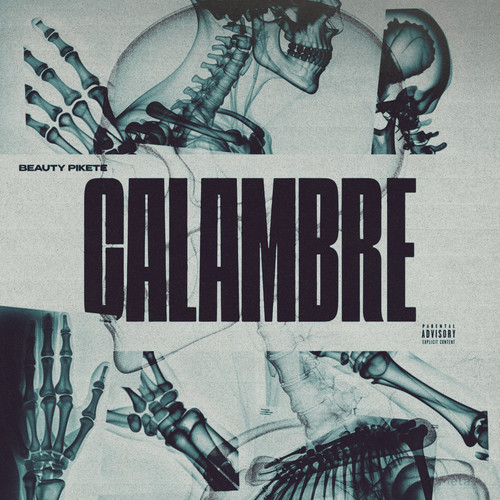 Calambre