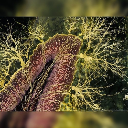 CEREBELLUM (Explicit)