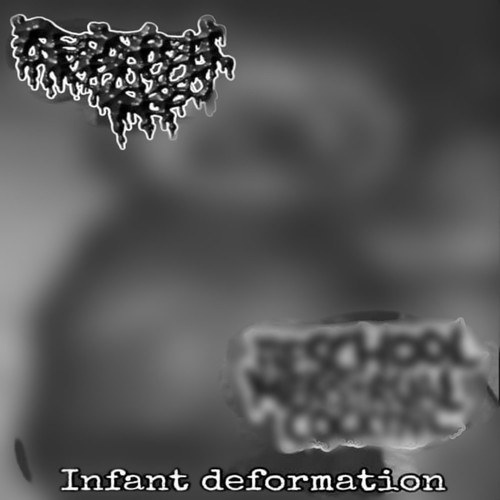 Infant Deformation