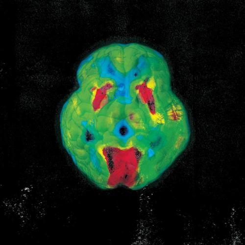 Brains (Explicit)