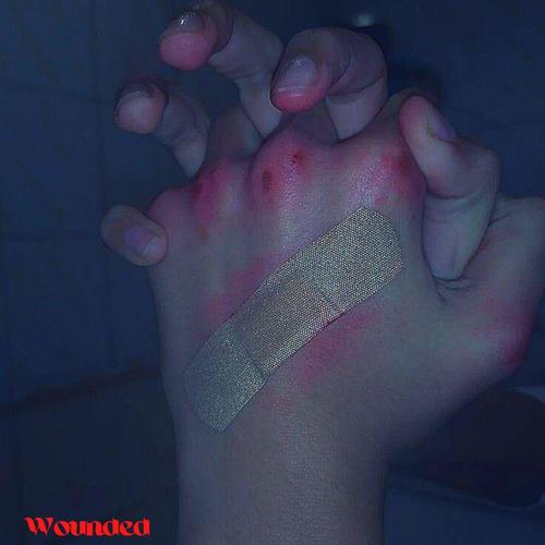Wounded