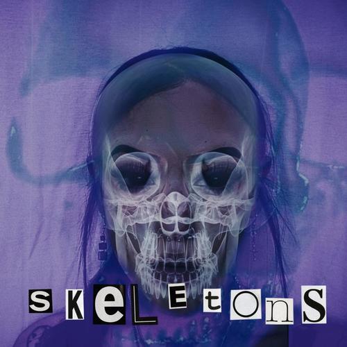 Skeletons (Explicit)