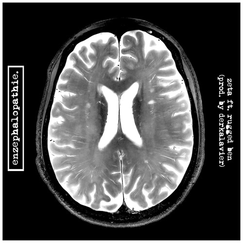 Enzephalopathie (Explicit)