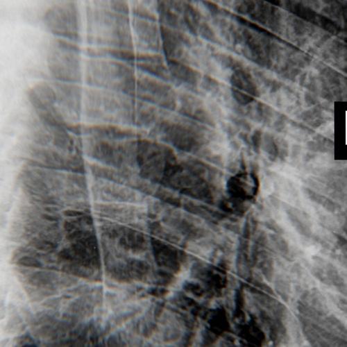 Human Volcano  (Bush Mix)