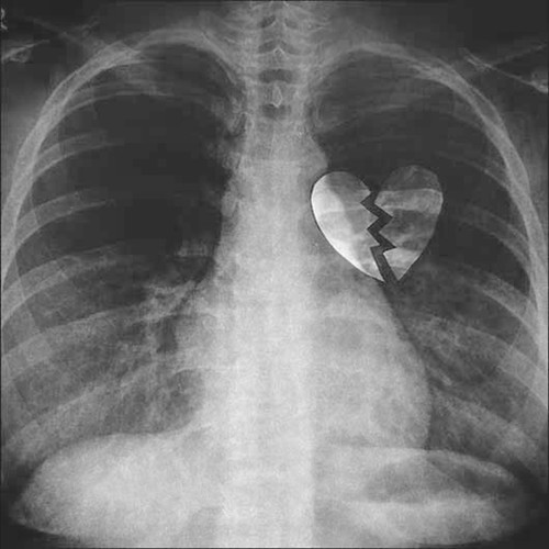 Nope your too late i already died (Dance Version)