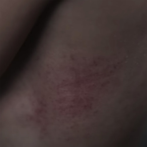 ถึง ผู้มีส่วนเกี่ยวข้อง (ตอนที่ 2 เคยได้หายใจ) [Explicit]