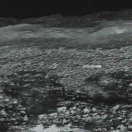 ZIGOUILLE & RACISME (Explicit)