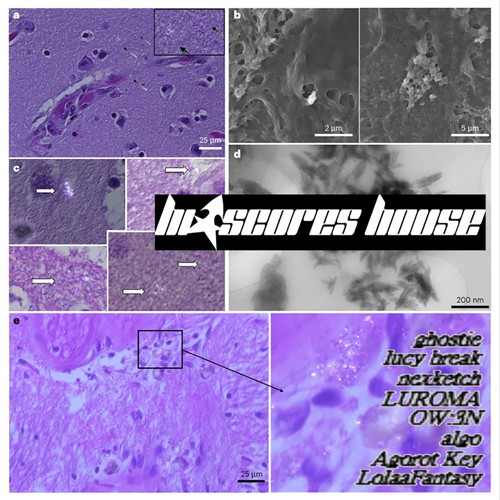 Microplastics (Explicit)