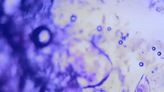 Alpines - Ice And Arrows