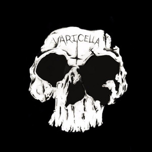 Varicella