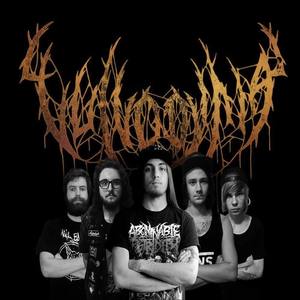 Vulvodynia