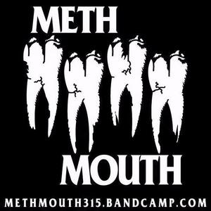 Meth Mouth