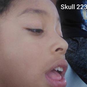 Skull223 (Explicit)