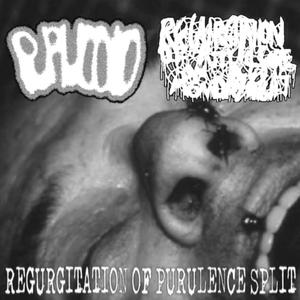 Ruptured Ear Drums Leaking Blood and Cranial Fluid