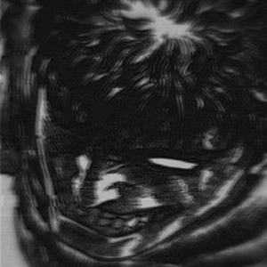 Voices Inside Me Won’t Let Me Go To Sleep (Radio Edit)