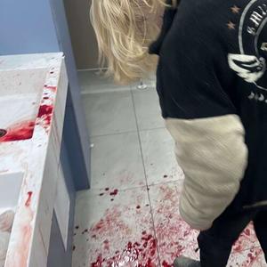 шрамы (Explicit)