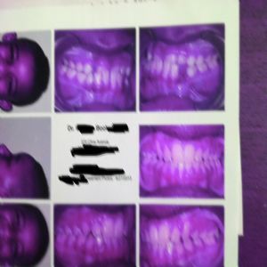 MY EN3RGY (SPED UP) (remix|Explicit)