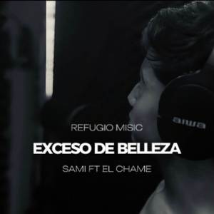 Exceso de belleza