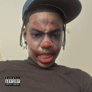 ILBB2 (Explicit)