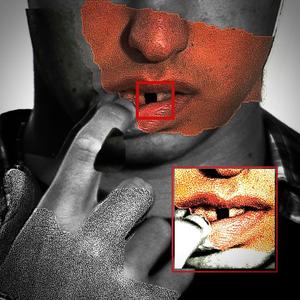 DENTI DA LATTE (Explicit)