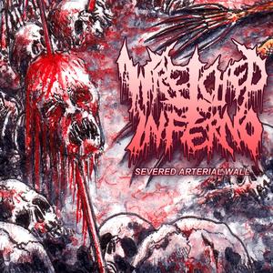 Severed Arterial Wall (Explicit)