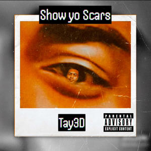 Show yo scars (Explicit)