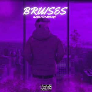 Bruises (Explicit)