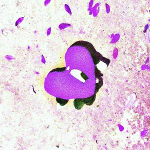 Mamichula (Explicit)