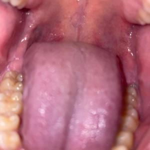 You Look ****ed Up (Explicit)