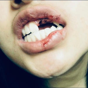 CRASH OUT (Explicit)