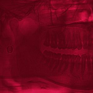 Teeth