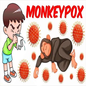 Monkeypox