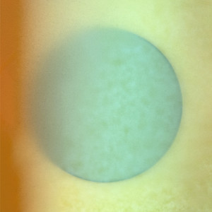 Tidal Love Conversation In That Familiar Golden Orchard (Edit)