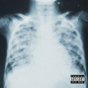 X-RAY (Explicit)