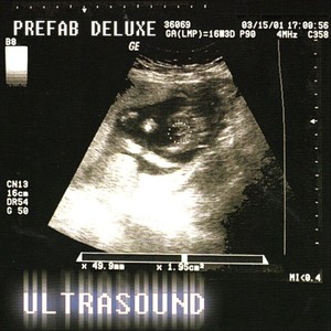 Ultrasound