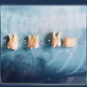 MISSING TEETH (Explicit)