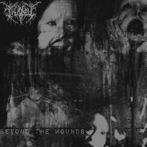 Broken Bones (feat. минута агонии)