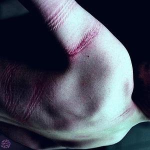 The Nachash — Plagued (Inst.)