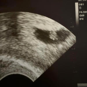 6Teen - Like An Opp (Explicit)