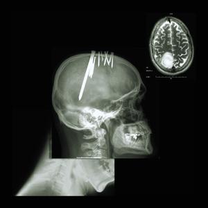 SOUND OF METAL (feat. KU$$in) (Explicit)