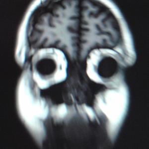 Jonas Schilling - Frühjahrsputz