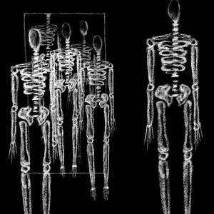 The Skeletons Have Escaped From My Closet