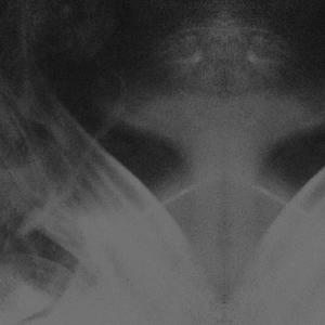 fall from the sky (hoodtrap) + super slowed