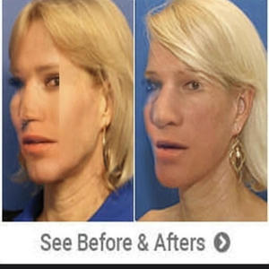 cypher (feat. ocelot, 3c876, sages & kasyuho) (Explicit)