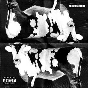 Vitiligo (Explicit)