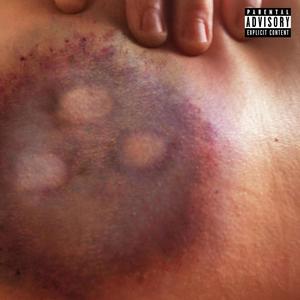 bruises (Explicit)